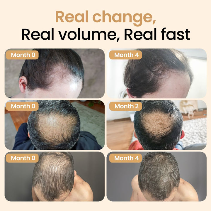 Hair Booster with Capilia Longa Stem Cells and growth factors – Pack of 2