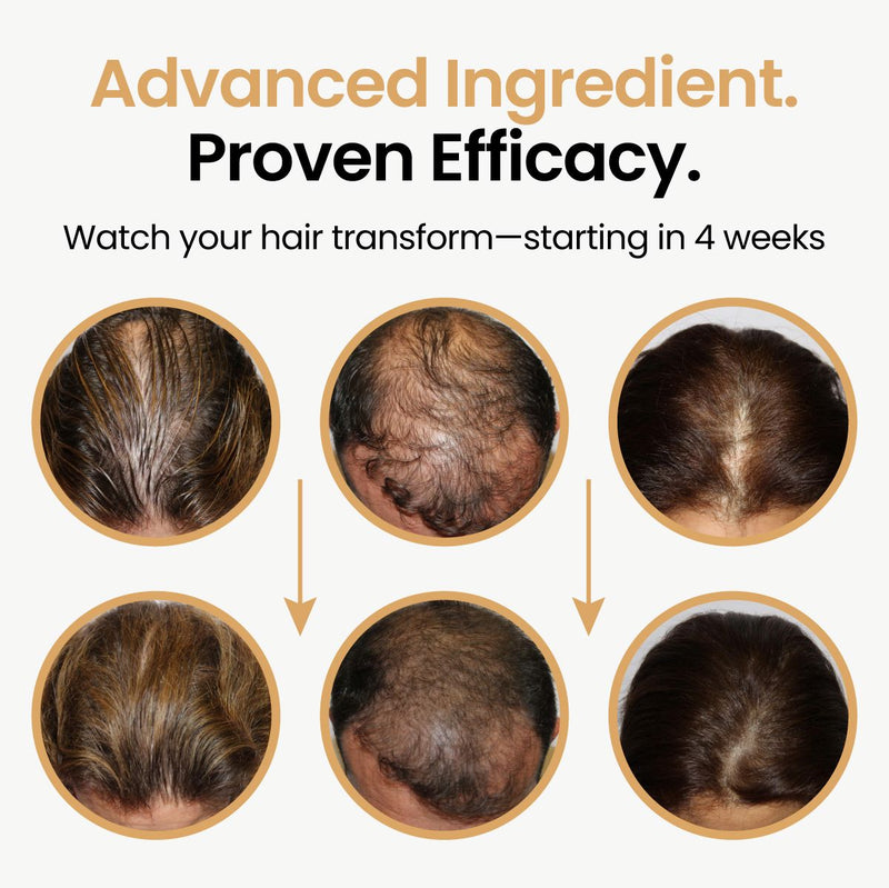 Hair Booster with Capilia Longa Stem Cells and Growth Factors – Buy 2, Get 1 Free