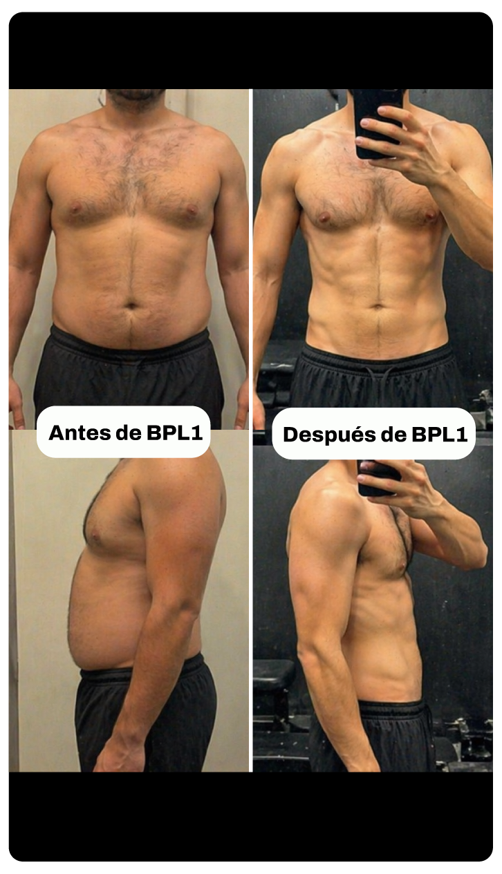 Antes y después BPL1
