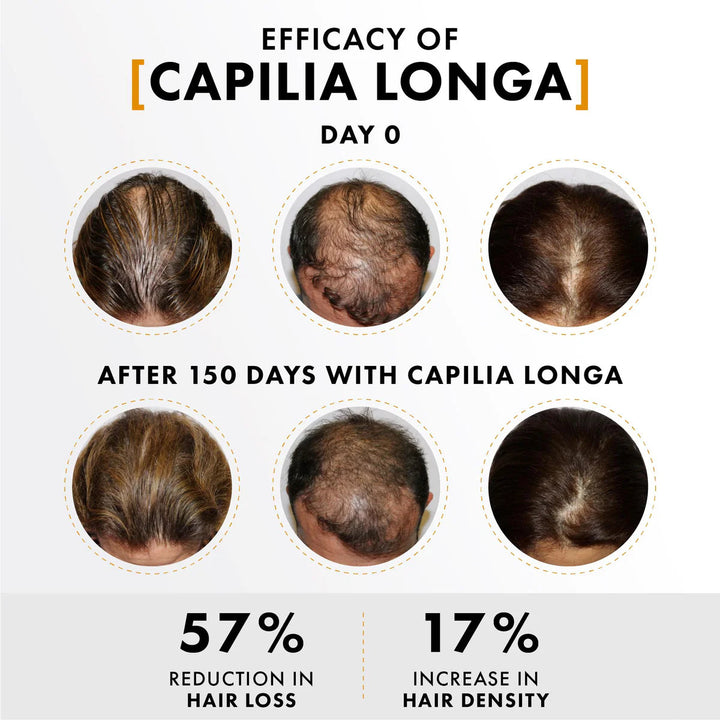 Hair Growth Spray with Capilia Longa Stem Cells + Capillary Ampoule