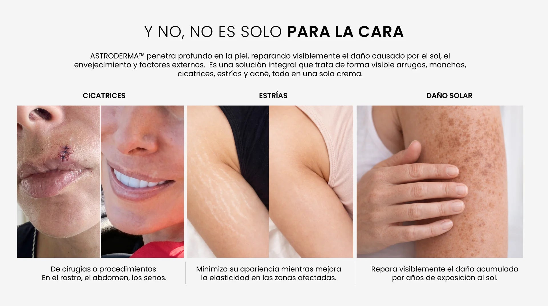 Y no, no es solo para la cara — Astroderma repara visiblemente cicatrices, estrías y daño solar